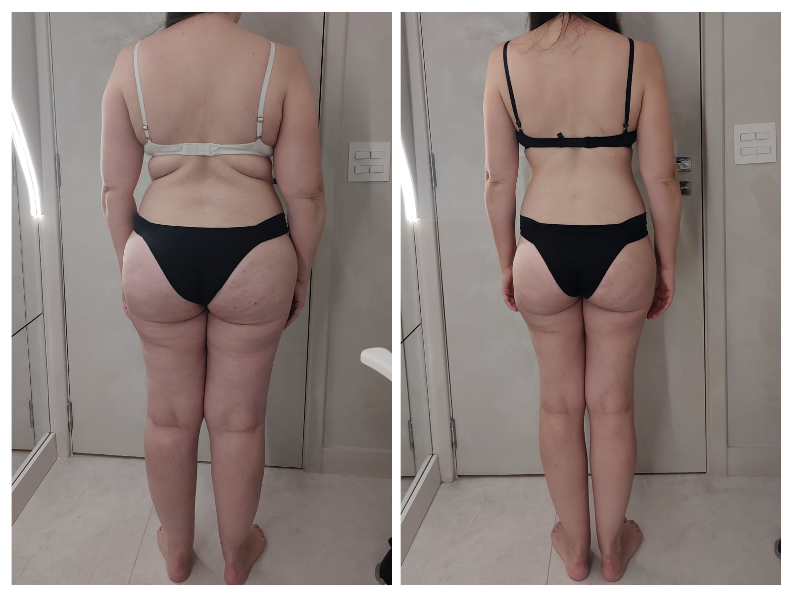 Comparação antes e depois do acompanhamento — registro 2