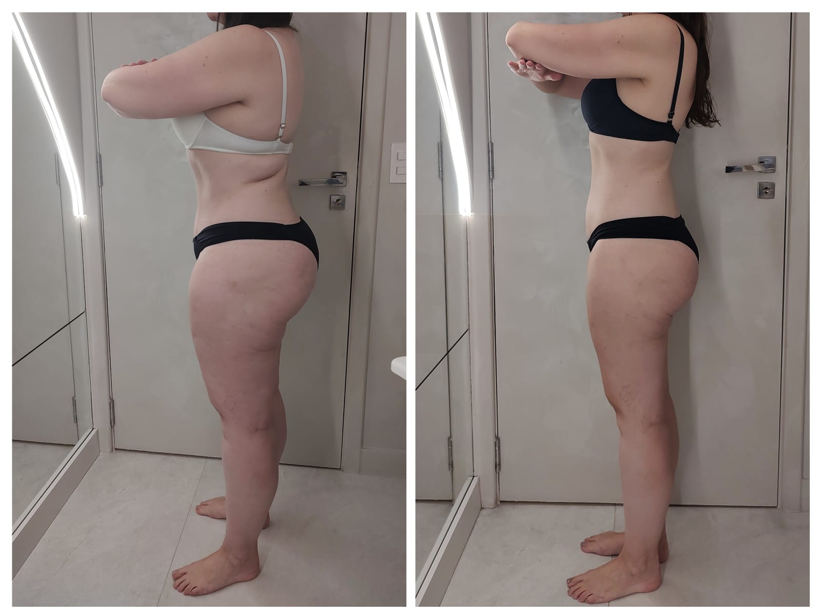 Comparação antes e depois do acompanhamento — registro 1