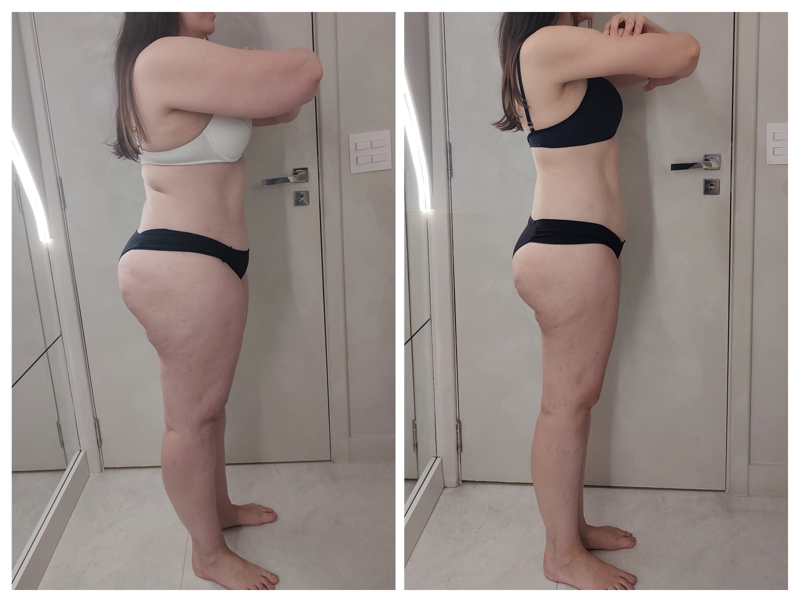 Comparação antes e depois do acompanhamento — registro 3